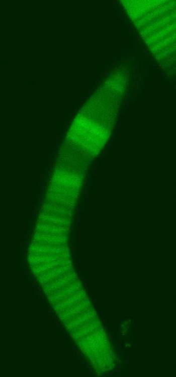 a genetic flaw causes the rod to bend and fail bending eye rod